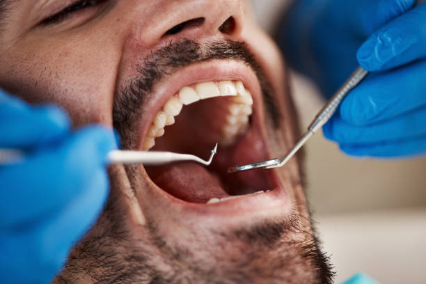 Best Cracked Tooth Emergency Dentist  in Southside, AR
